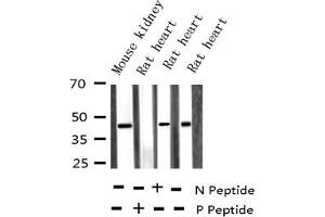 Western blot analysis of Phospho-MKK3 (Ser189) expression in various lysates (MAP2K3 anticorps  (pSer189))