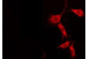 ABIN6274839 staining HuvEc by IF/ICC.