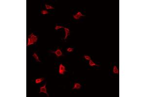 ABIN6272329 staining COLO205 by IF/ICC. (IL1RAPL2 anticorps  (Internal Region))
