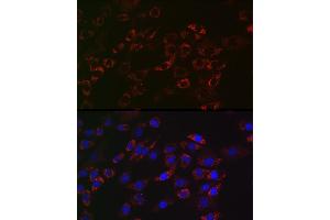 Immunofluorescence analysis of NIH/3T3 cells using  Rabbit mAb (ABIN7265367) at dilution of 1:100 (40x lens).