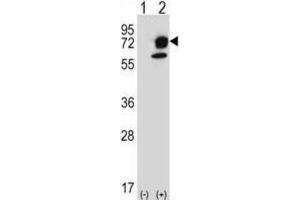 Western Blotting (WB) image for anti-Inositol-Trisphosphate 3-Kinase B (ITPKB) antibody (ABIN5024070) (ITPKB anticorps)