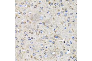 Immunohistochemistry of paraffin-embedded rat brain using MAP1LC3B antibody (ABIN5998170) at dilution of 1/100 (40x lens). (LC3B anticorps)