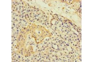 Immunohistochemistry of paraffin-embedded human pancreatic tissue using ABIN7143774 at dilution of 1:100 (A4GNT anticorps  (AA 26-340))