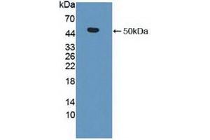 Detection of Recombinant MMP19, Human using Polyclonal Antibody to Matrix Metalloproteinase 19 (MMP19) (MMP19 anticorps  (AA 98-508))