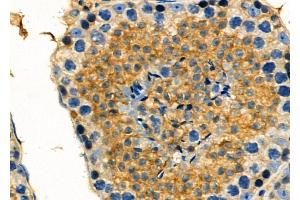 ABIN6261469 and ABIN6278061 at 1/100 staining Mouse testis tissue by IHC-P. (EHD1 anticorps  (C-Term))