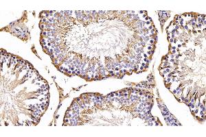 Detection of PRDX2 in Rat Testis Tissue using Polyclonal Antibody to Peroxiredoxin 2 (PRDX2) (Peroxiredoxin 2 anticorps  (AA 6-164))