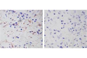 Immunohistochemistry analysis of human spleen tissue slide (Paraffin embedded) using Rabbit Anti-Vimentin Polyclonal Antibody (Left, ABIN398721) and Purified Rabbit IgG (Whole molecule) Control (Right, ABIN398653) (Vimentin anticorps  (AA 400-500))