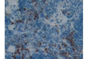 DAB staining on IHC-P; Samples: Rat Spleen Tissue (PGLYRP1 anticorps  (AA 18-183))