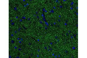 Indirect immunostaining of PFA fixed paraffin embedded mouse spinal cord section (dilution 1 : 500; green). (Alpha, beta Synuclein (AA 1-140) anticorps)