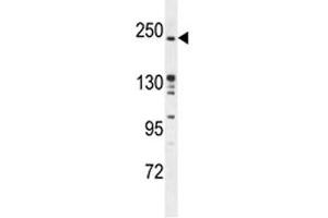 RICTOR antibody western blot analysis in mouse bladder tissue lysate.