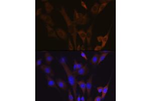 Immunofluorescence analysis of NIH-3T3 cells using  Rabbit mAb (ABIN7265739) at dilution of 1:100 (40x lens).