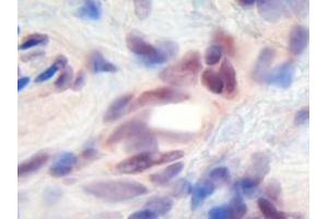 Image no. 1 for anti-Melanoma Inhibitory Activity (MIA) antibody (ABIN464851) (MIA anticorps)