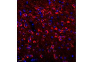 Immunofluorescence of paraffin embedded mouse brain using CRMP3 (ABIN7073734) at dilution of 1:650 (400x lens)
