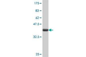 Western Blot detection against Immunogen (37.