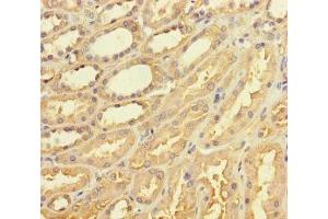 Immunohistochemistry of paraffin-embedded human kidney tissue using ABIN7171552 at dilution of 1:100 (TAS2R42 anticorps  (AA 149-187))