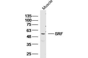 Mouse muscle lysates probed with SRF Polyclonal Antibody, unconjugated  at 1:300 overnight at 4°C followed by a conjugated secondary antibody at 1:10000 for 90 minutes at 37°C. (SRF anticorps  (AA 101-250))