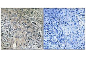 Immunohistochemistry (IHC) image for anti-Coatomer Protein Complex, Subunit zeta 1 (COPZ1) (N-Term) antibody (ABIN1851138) (COPZ1 anticorps  (N-Term))