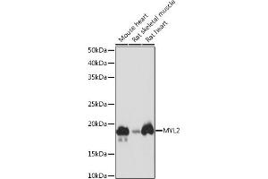 Western blot analysis of extracts of various cell lines, using MYL2 Rabbit mAb (ABIN7268761) at 1:1000 dilution.