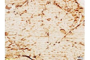 Formalin-fixed and paraffin embedded mouse liver tissue labeled with Anti-TIMP-3 Polyclonal Antibody , Unconjugated at 1:100, followed by conjugation to the secondary antibody and DAB staining (TIMP3 anticorps  (AA 151-211))