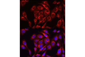 anti-Mitofusin 1 (MFN1) (AA 622-741) antibody