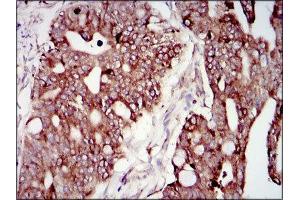 Immunohistochemistry (IHC) image for anti-Phosphoinositide 3 Kinase, p85 alpha (PI3K p85a) (AA 159-388) antibody (ABIN1844692)