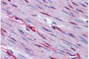 Human Colon, Muscularis Propria and Nerve: Formalin-Fixed, Paraffin-Embedded (FFPE)