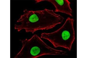 Fluorescent image of HeLa cells stained with SUMO-2 antibody at 1:25 dilution. (SUMO2 anticorps)