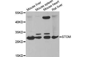 Western blot analysis of extracts of various cell lines, using STOM antibody (ABIN5973779) at 1/1000 dilution. (Stomatin anticorps)