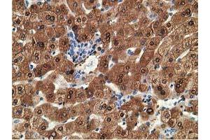 Immunohistochemical staining of paraffin-embedded Human liver tissue using anti-ADH1B mouse monoclonal antibody. (ADH1B anticorps)