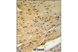 PLB-T17 Antibody (ABIN653840 and ABIN2843104) IHC analysis in formalin fixed and paraffin embedded mouse heart tissue followed by peroxidase conjugation of the secondary antibody and DAB staining. (PLB-T17 (AA 1-30) anticorps)
