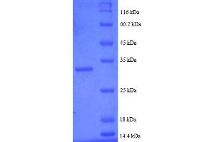 Metallothionein 2 (MT2) (AA 1-59), (partial) protein (GST tag)