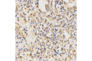 Immunohistochemistry (IHC) image for anti-ATG5 Autophagy Related 5 (ATG5) (AA 1-275) antibody (ABIN3020674) (ATG5 anticorps  (AA 1-275))