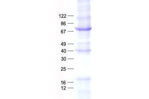Validation with Western Blot