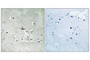 Immunohistochemistry (IHC) image for anti-Neurotrophic Tyrosine Kinase, Receptor, Type 2 (NTRK2) (pTyr706), (pTyr707) antibody (ABIN1847660) (TRKB anticorps  (pTyr706, pTyr707))