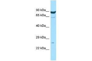 WB Suggested Anti-MS4A7 Antibody Titration: 1. (MS4A7 anticorps  (Middle Region))