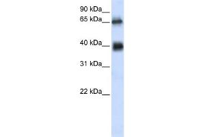 WB Suggested Anti-C6orf113 Antibody Titration:  0. (ZUFSP anticorps  (Middle Region))