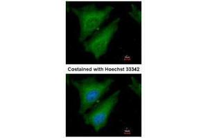 ICC/IF Image Immunofluorescence analysis of paraformaldehyde-fixed HeLa, using SOCS4, antibody at 1:200 dilution. (SOCS4 anticorps  (C-Term))