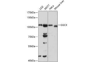 Western blot analysis of extracts of various cell lines, using GGCX antibody (ABIN6129015, ABIN6141069, ABIN6141070 and ABIN6218918) at 1:1000 dilution. (GGCX anticorps  (AA 479-758))