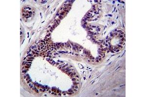 JNK1 antibody immunohistochemistry analysis in formalin fixed and paraffin embedded human breast tissue.