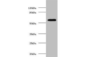 Western blot All lanes: OXCT1 antibody at 2 μg/mL + Hela whole cell lysate Secondary Goat polyclonal to rabbit IgG at 1/15000 dilution Predicted band size: 57, 14 kDa Observed band size: 57 kDa (OXCT1 anticorps  (AA 40-520))
