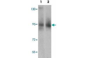 Western blot analysis of ZBTB5 in mouse brain tissue lysate with ZBTB5 polyclonal antibody  at (1) 1 and (2) 2 ug/mL.