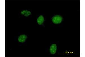 Immunofluorescence of purified MaxPab antibody to HGD on HeLa cell. (HGD anticorps  (AA 1-445))