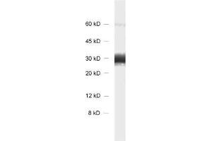 dilution: 1 : 1000, sample: rat brain homogenate. (Synaptogyrin 1 anticorps)