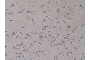 IHC-P analysis of Human Brain Tissue, with DAB staining. (Prosaposin anticorps  (AA 17-524))