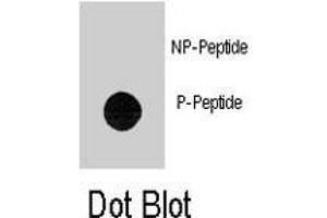 Dot blot analysis of TEK (phospho Y1113) polyclonal antibody  on nitrocellulose membrane. (TEK anticorps  (pTyr1113))