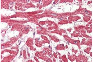 Heart, Human: Formalin-Fixed, Paraffin-Embedded (FFPE)