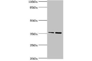 Western blot All lanes: CFHR2 antibody at 2 μg/mL Lane 1: Hela whole cell lysate Lane 2: 293T whole cell lysate Secondary Goat polyclonal to rabbit IgG at 1/10000 dilution Predicted band size: 31, 28 kDa Observed band size: 36 kDa (CFHR2 anticorps  (AA 20-269))