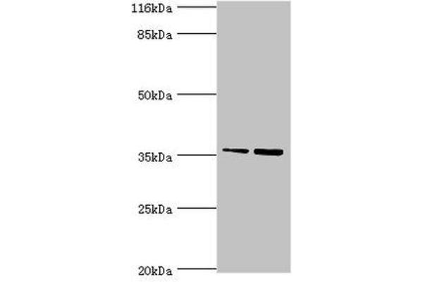 CFHR2 anticorps  (AA 20-269)