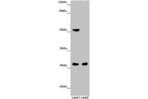 Western blot All lanes: CHTOP antibody at 14 μg/mL Lane 1: Mouse heart tissue Lane 2: Mouse kidney tissue Secondary Goat polyclonal to rabbit IgG at 1/10000 dilution Predicted band size: 27, 22 kDa Observed band size: 27, 52 kDa (CHTOP anticorps  (AA 179-248))