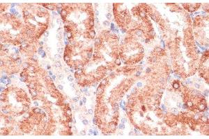 Immunohistochemistry of paraffin-embedded Rat kidney using RPIA Polyclonal Antibody at dilution of 1:100 (40x lens). (Ribose 5-Phosphate Isomerase A (RPIA) anticorps)